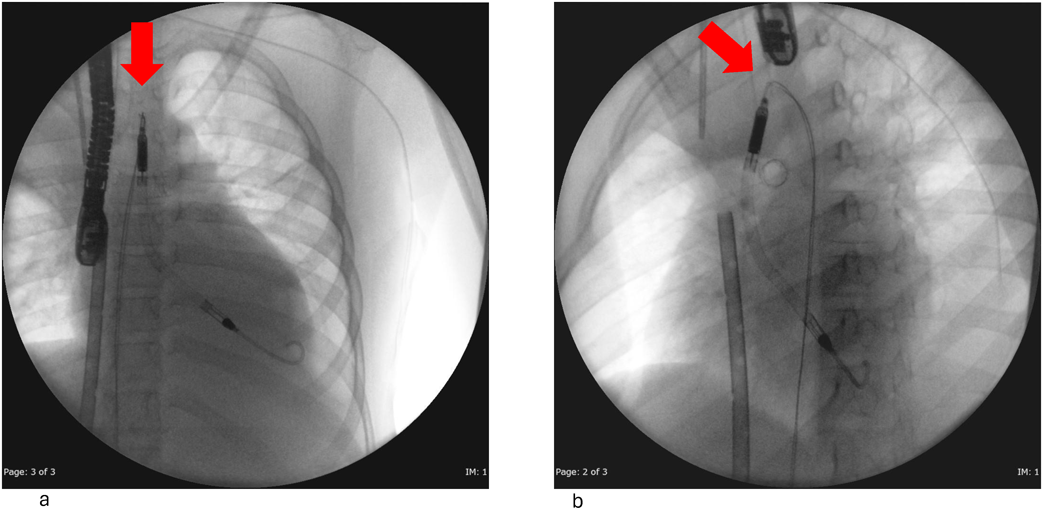 Journal of JCIC 10(1): 8-13 (2025)