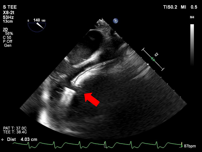 Journal of JCIC 10(1): 8-13 (2025)