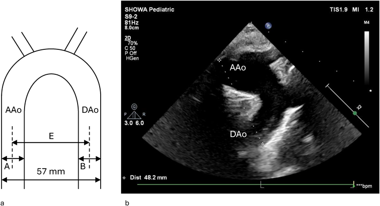 Journal of JCIC 10(1): 8-13 (2025)